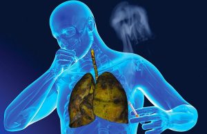 Kolla e duhanit, kur përbën rrezik për jetën?