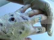 Crockadeal – eshte droga me tmerruese ne bote qe qarkullon