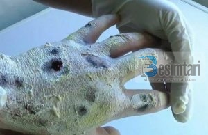 Crockadeal – eshte droga me tmerruese ne bote qe qarkullon