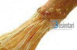 Misvaku (pastrimi i dhëmbëve) dhe pastërtia vetjake