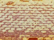 Mjalti “Buka e bleteve”