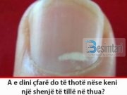 A e dini çfarë do të thotë nëse keni një shenjë të tillë në thua?