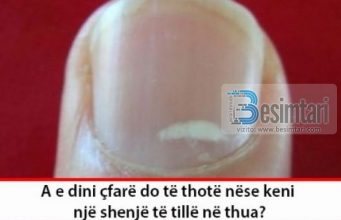 A e dini çfarë do të thotë nëse keni një shenjë të tillë në thua?