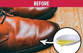 14 mënyra për të hequr çdo gërvishtje