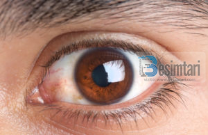 Tre sy të ndaluar për zjarrin