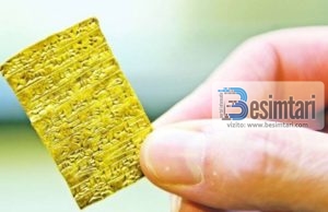 A lejohet bartja e hajmalisë në Islam?