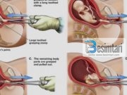 A do të mund të duroni juve tu priten duart, këmbët, koka dhe çdo organ një nga një…?