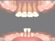Zhvillimi i dhëmbëve i paraqitur me video