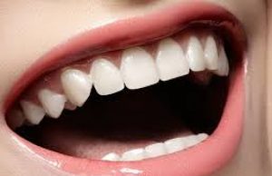 Zbardhni dhëmbët dhe hiqni gurrëzat në kushte shtëpie