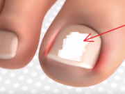 Nëse keni problem me gishtin e madh të këmbes!