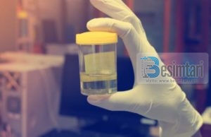 Ngjyra e urinës tregon gjithçka që duhet të dini për shëndetin tuaj