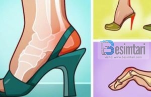 Le te mos kërcasin me këmbet e tyre