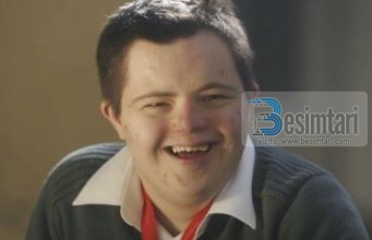 “Shikoni zonjë… personat me Sindromën Daun nuk jetojnë më shumë se… “