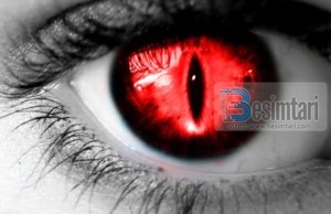 Ç’ËSHTË ZEMËRIMI ?