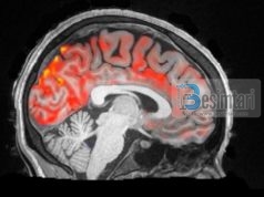 Si duket shpëlarja e vërtetë e trurit?