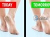 Fërkoni këmbët me këtë dhe do të largoni të çarat e thembrave brenda 1 dite