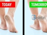 Fërkoni këmbët me këtë dhe do të largoni të çarat e thembrave brenda 1 dite