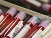 Pse është e rëndësishme ta dimë se çfarë lloji të gjakut kemi?