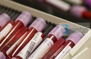 Pse është e rëndësishme ta dimë se çfarë lloji të gjakut kemi?